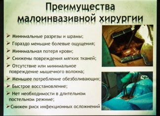 Малоінвазивні операції: плюси